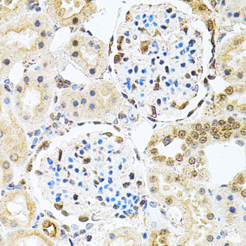 Immunohistochemistry of paraffin-embedded rat kidney using PNKP antibody  at dilution of 1:100 