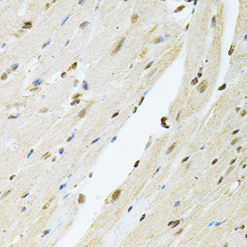 a03566 1 pnkp primary antiboties ihc testing 4
