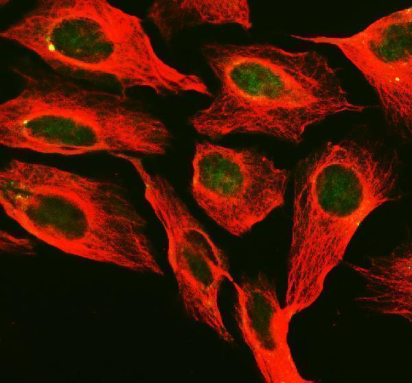 IF analysis of PNKP using anti-PNKP antibody (A03566-2) and anti-Beta Tubulin antibody (M01857-3)