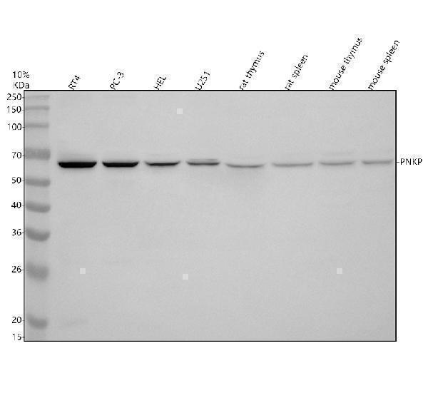 Western blot analysis of PNKP using anti-PNKP antibody (A03566-2)