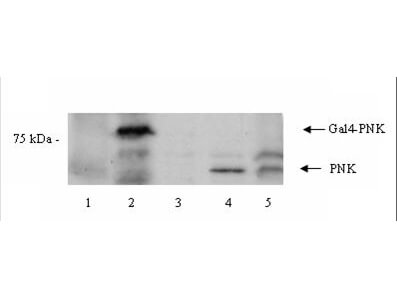 Western blot using Boster's Affinity Purified anti-PNK antibody shows detection of a 57 kDa band corresponding to human PNK in a Y190 yeast cell lysate (lane 1), Y190 yeast cell lysate + human PNK (Gal DNA BP) (lane 2), EM9 XH Chinese hamster ovary cell lysate (lane 3), EM9 XH Chinese hamster ovary cell lysate + human PNK (lane 4) and a HeLa cell lysate (lane 5)