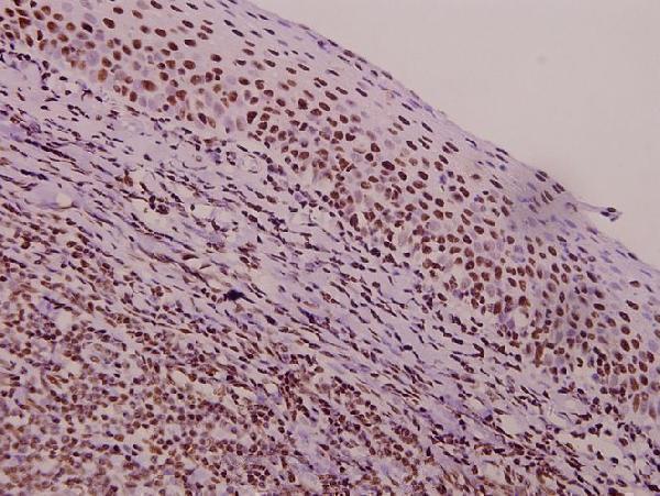 a03569 1 tacstd2 primary antiboties ihc testing 2