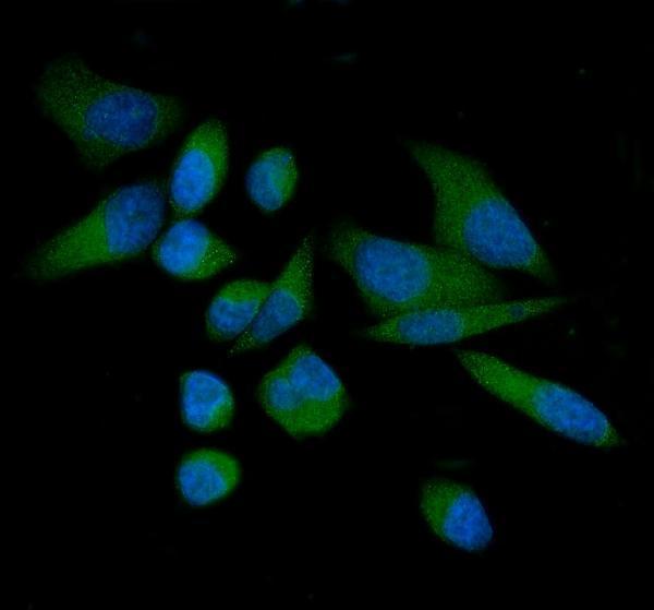 a03569 2 tacstd2 primary antibodies if testing 2