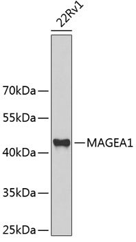 Western blot analysis of MAGEA1 antibody at 1:1000 dilution