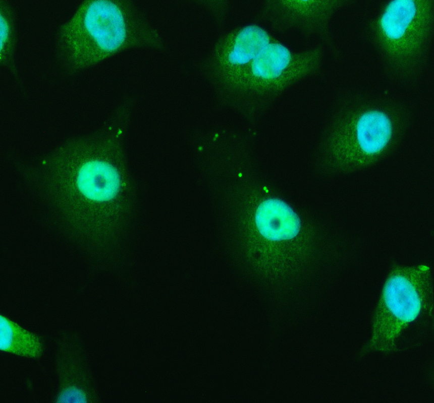 a03571 1 rpl13a primary antibodies if testing 1