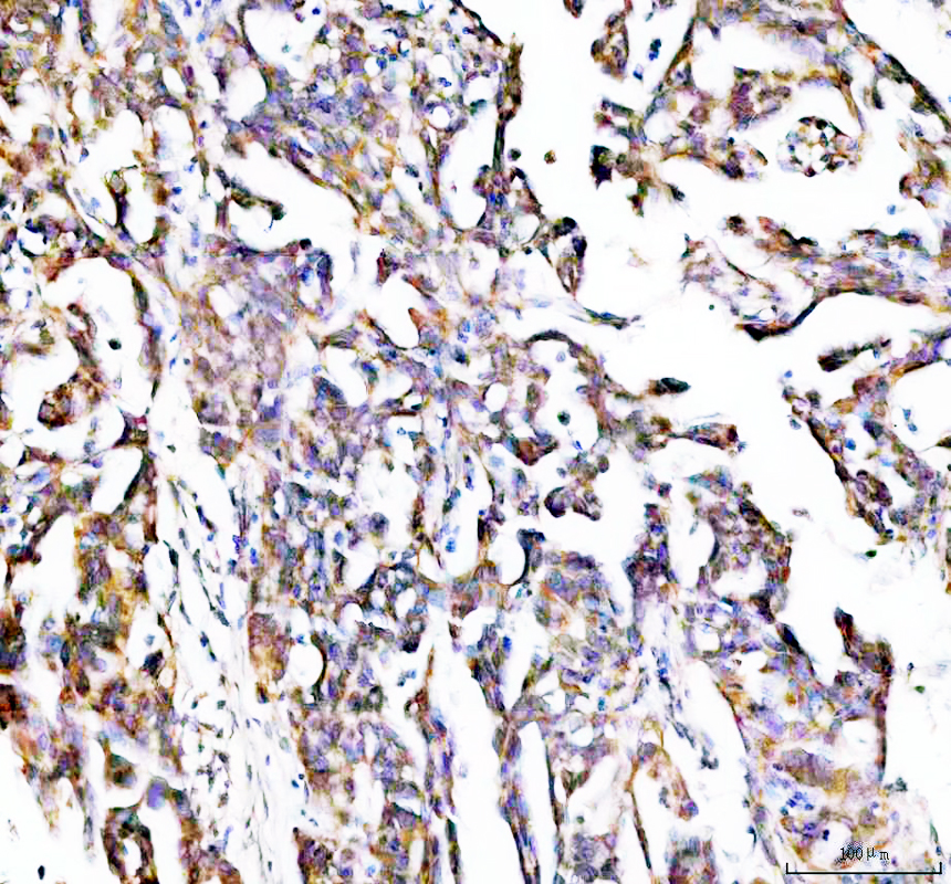 IHC analysis of RPL13A using anti-RPL13A antibody (A03571-1)