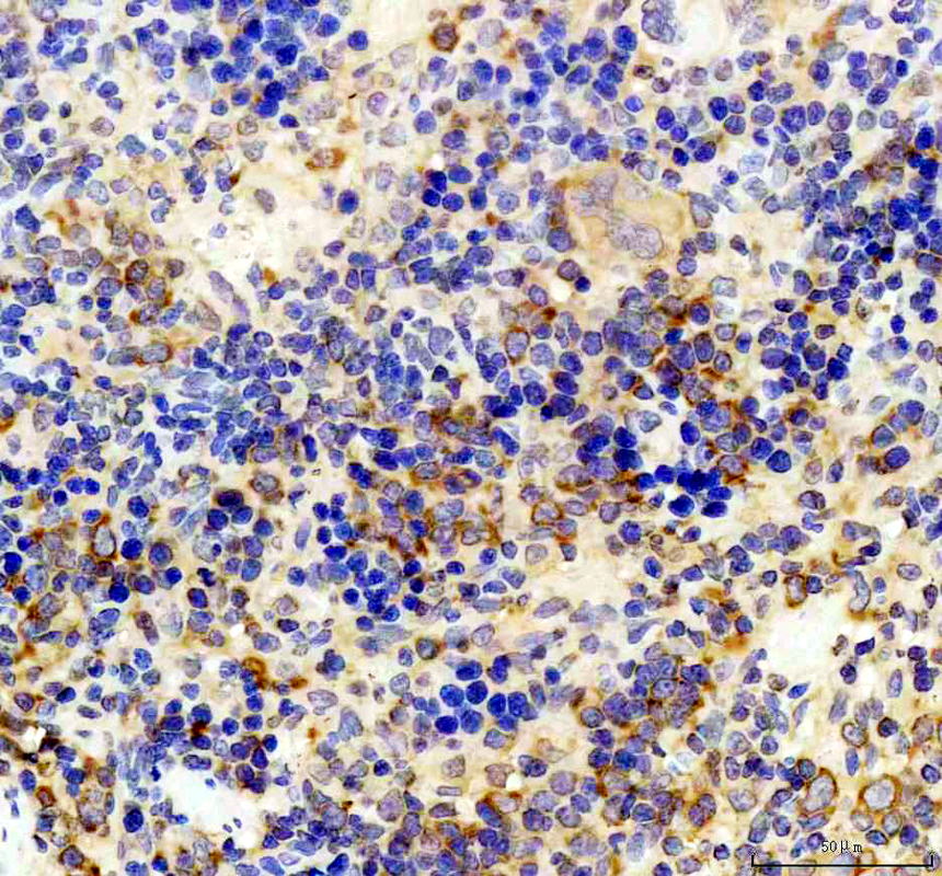 IHC analysis of RPL13A using anti-RPL13A antibody (A03571-1)