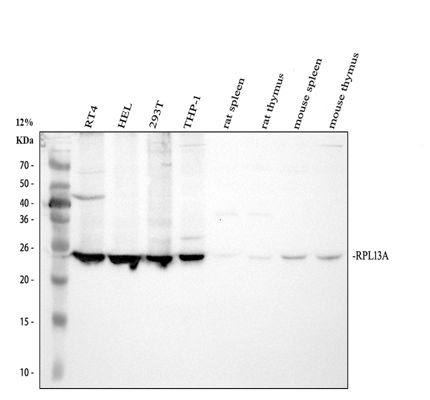 Western blot analysis of RPL13A using anti-RPL13A antibody (A03571-1)