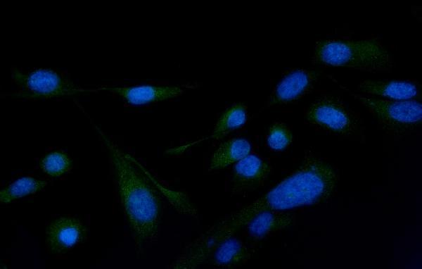 a03572 1 plcg2 primary antibodies if testing 3