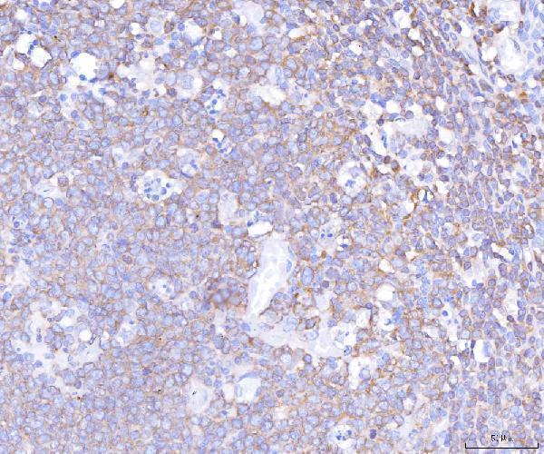 a03572 1 plcg2 primary antibodies ihc testing 2