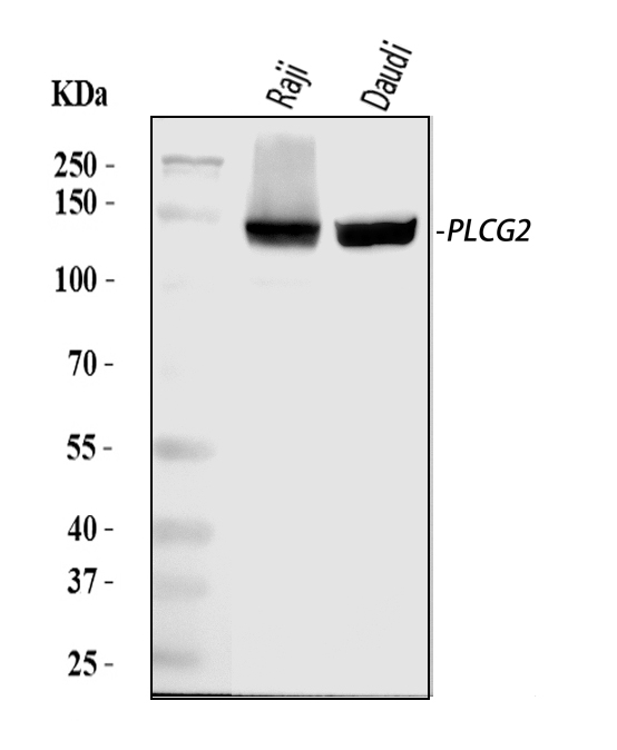 a03572 1 plcg2 primary antibodies wb testing 1