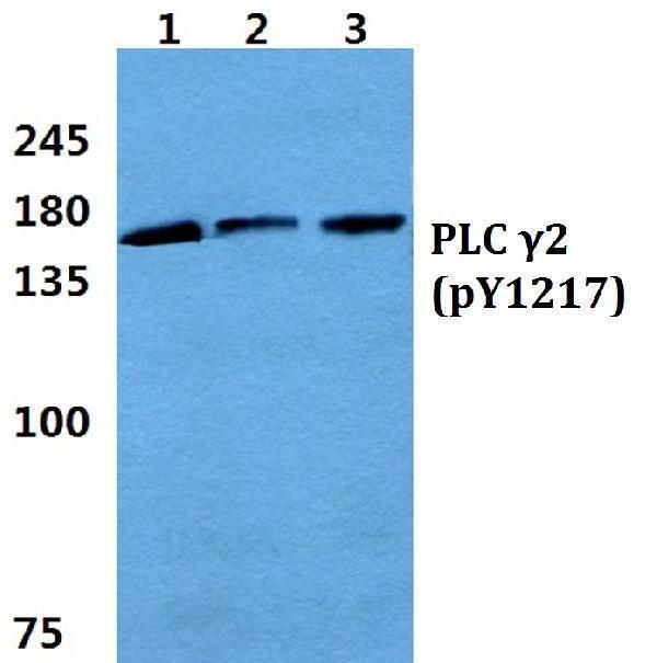 a03572y1217 plcg2 primary antiboties wb testing 1