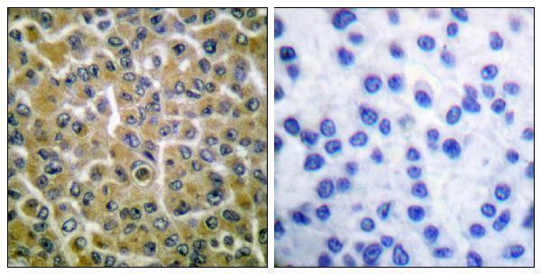 a03572y753 1 plcg2 primary antibodies ihc testing 1