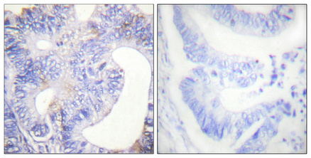 a03572y753 1 plcg2 primary antibodies ihc testing 4