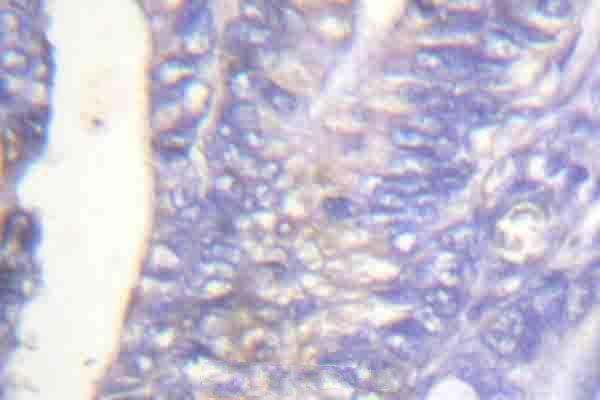 a03572y753 plcg2 primary antiboties ihc testing 2