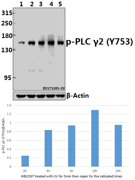 a03572y753 plcg2 primary antiboties wb testing 1