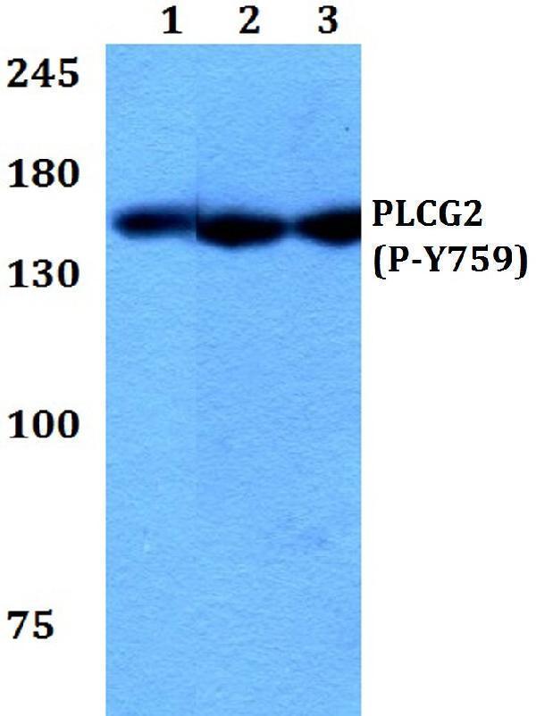 a03572y759 plcg2 primary antiboties wb testing 1