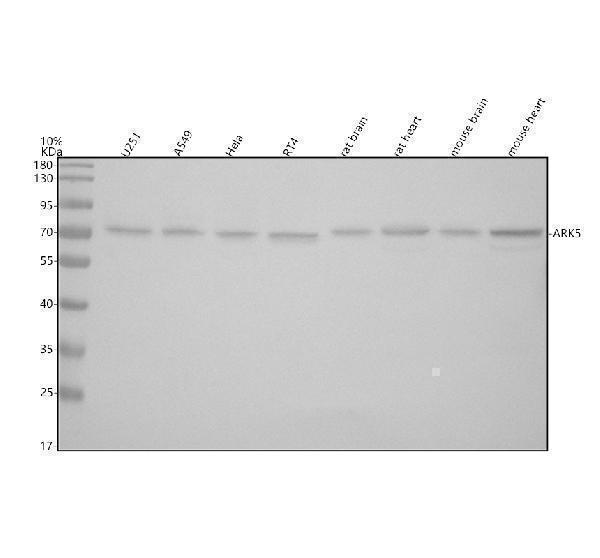 Western blot analysis of ARK5/NUAK1 using anti-ARK5/NUAK1 antibody (A03575-1)