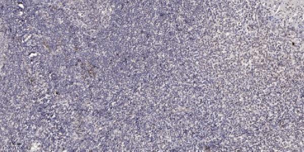 a03576 1 pinx1 primary antibodies ihc testing 1