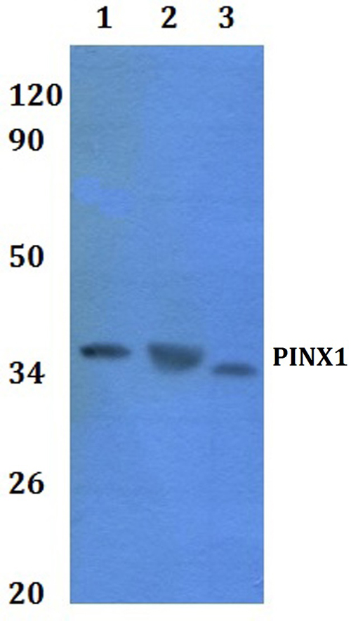 a03576 pinx1 primary antiboties wb testing 1