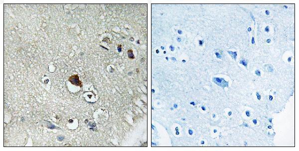 Immunohistochemistry analysis of paraffin-embedded human brain tissue, using DVL3 Antibody