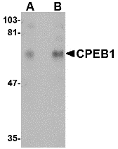 Western blot analysis of CPEB1 in rat brain tissue lysate with CPEB1 antibody at (A) 1 and (B) 2 μg/mL