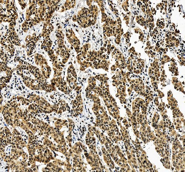 a03580 3 alyref primary antibodies ihc testing 1
