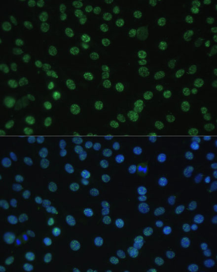 a03580 alyref primary antiboties if testing 4