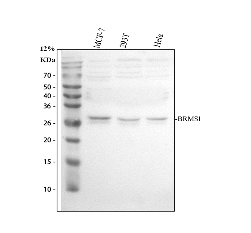 a03587 1 brms1 primary antibodies wb testing 1