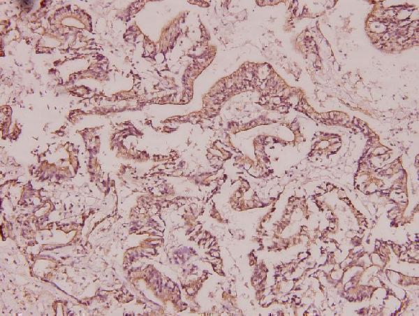 a03587 brms1 primary antiboties ihc testing 2