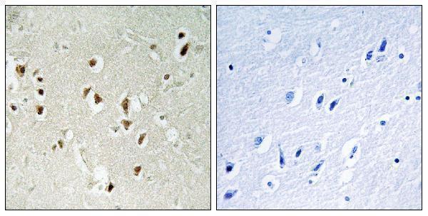 a03592 arhgap35 primary antibodies ihc testing 1