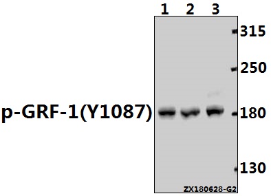 Western blot (WB) analysis of p-GRF-1 (Y1087) pAb at 1:1000 dilution
Lane1:MCF-7 whole cell lysate(40ug)
Lane2:HuT78 whole cell lysate(40ug)
Lane3:K562 whole cell lysate(40ug)