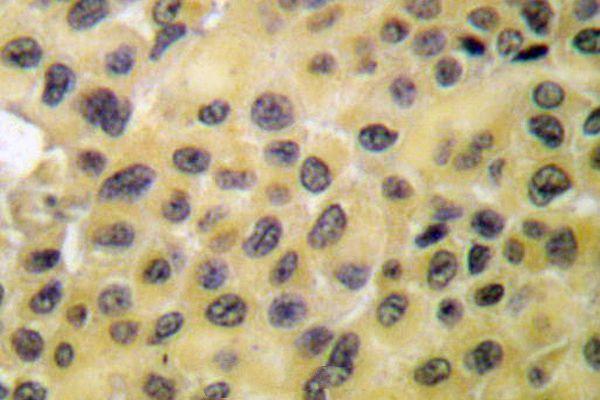 Immunohistochemistry (IHC) analyzes of p-GRF-1 (Y1105) pAb in paraffin-embedded human brain tissue