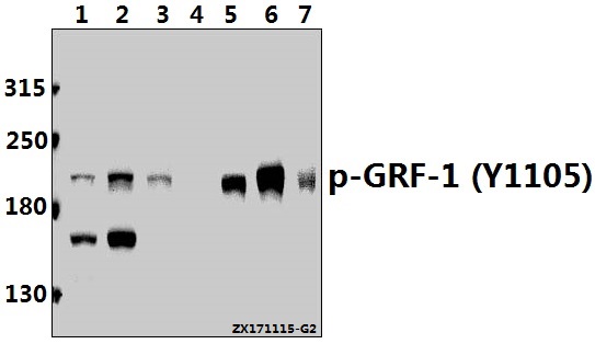 Western blot (WB) analysis of p-GRF-1 (Y1105) pAb at 1:500 dilution
Lane1:The Heart tissue lysate of Rat(40ug)
Lane2:K562 whole cell lysate(40ug)
Lane3:Jurkat whole cell lysate(40ug)
Lane4:The Blood tissue lysate of Mouse(40ug)
Lane5:H1792 whole cell lysate(40ug)
Lane6:HEK293T whole cell lysate(40ug)
Lane7:SP2/0 whole cell lysate(40ug)