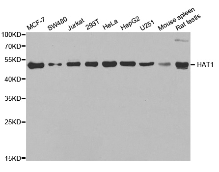 WesternBlot (WB) analysis of HAT1 polyclonal antibody
