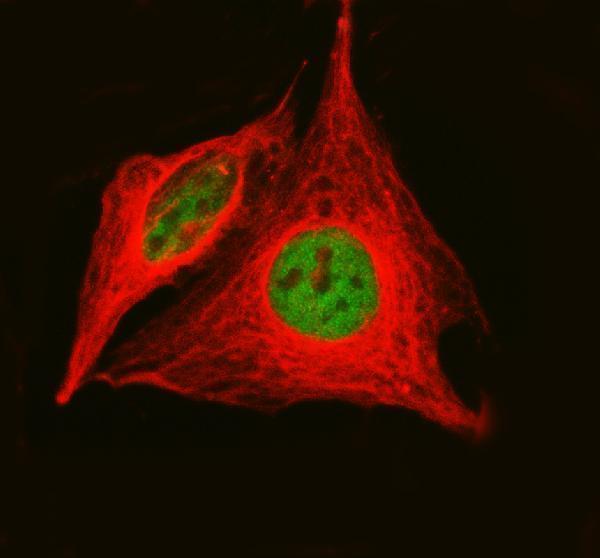 a03596 2 hat1 primary antibodies if testing 1