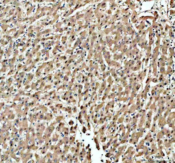 IHC analysis of KAT1/HAT1 using anti-KAT1/HAT1 antibody (A03596-2)
