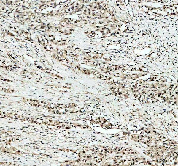 IHC analysis of KAT1/HAT1 using anti-KAT1/HAT1 antibody (A03596-2)