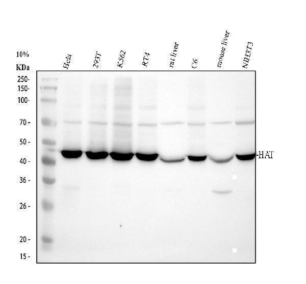 Western blot analysis of KAT1/HAT1 using anti-KAT1/HAT1 antibody (A03596-2)