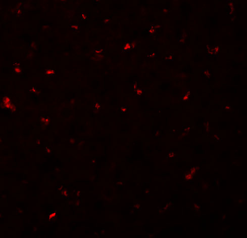 a03599 1 calhm1 primary antibodies if testing 3