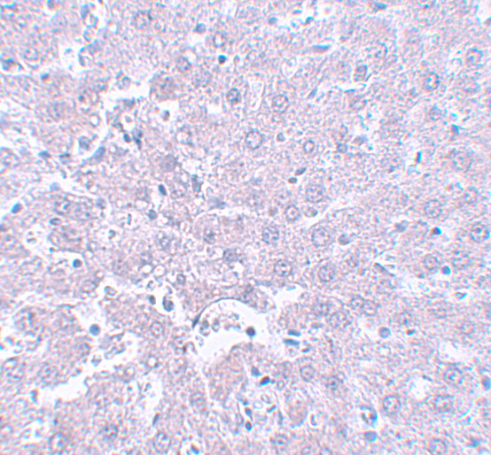 a03599 1 calhm1 primary antibodies ihc testing 2