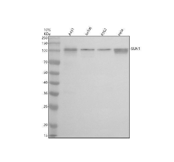 Western blot analysis of SUN1 using anti-SUN1 antibody (A03601-1)