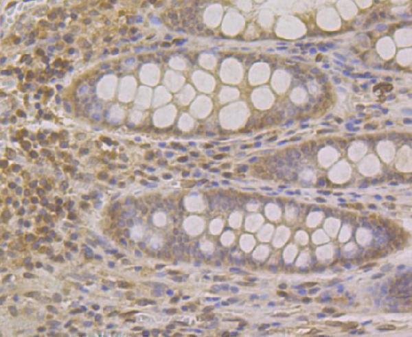 Immunohistochemical analysis of paraffin-embedded human colon tissue using anti-SUN1 antibody