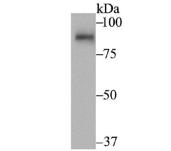 Western blot analysis of SUN1 on rat kidney tissue lysate using anti-SUN1 antibody at 1:2000 dilution