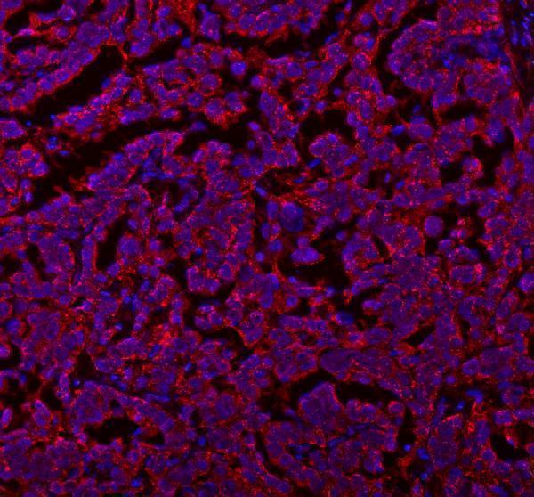 a03602 2 slc7a7 primary antibodies if testing 4