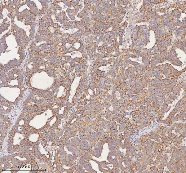  IHC analysis of SLC7A7 using anti-SLC7A7 antibody (A03602-2)