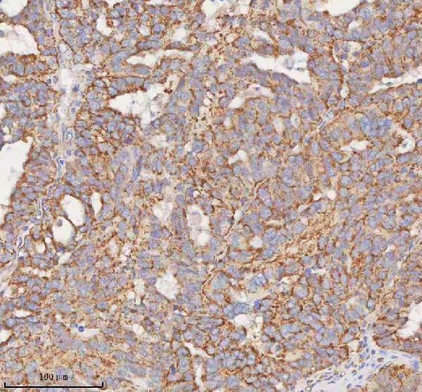  IHC analysis of SLC7A7 using anti-SLC7A7 antibody (A03602-2)