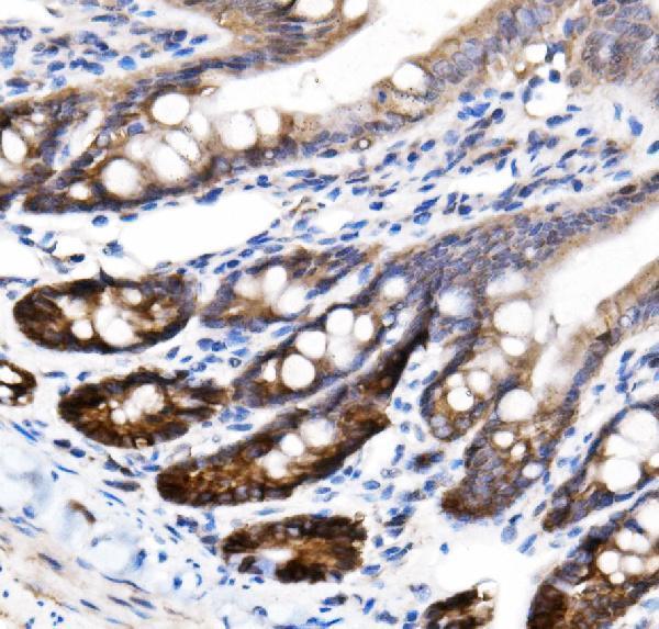 a03603 slc12a2 primary antibodies ihc testing 4
