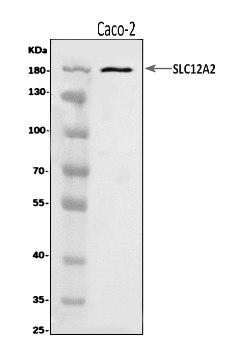  Western blot analysis of NKCC1/SLC12A2 using anti-NKCC1/SLC12A2 antibody (A03603)