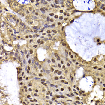 a03604 arid3a primary antiboties ihc testing 2